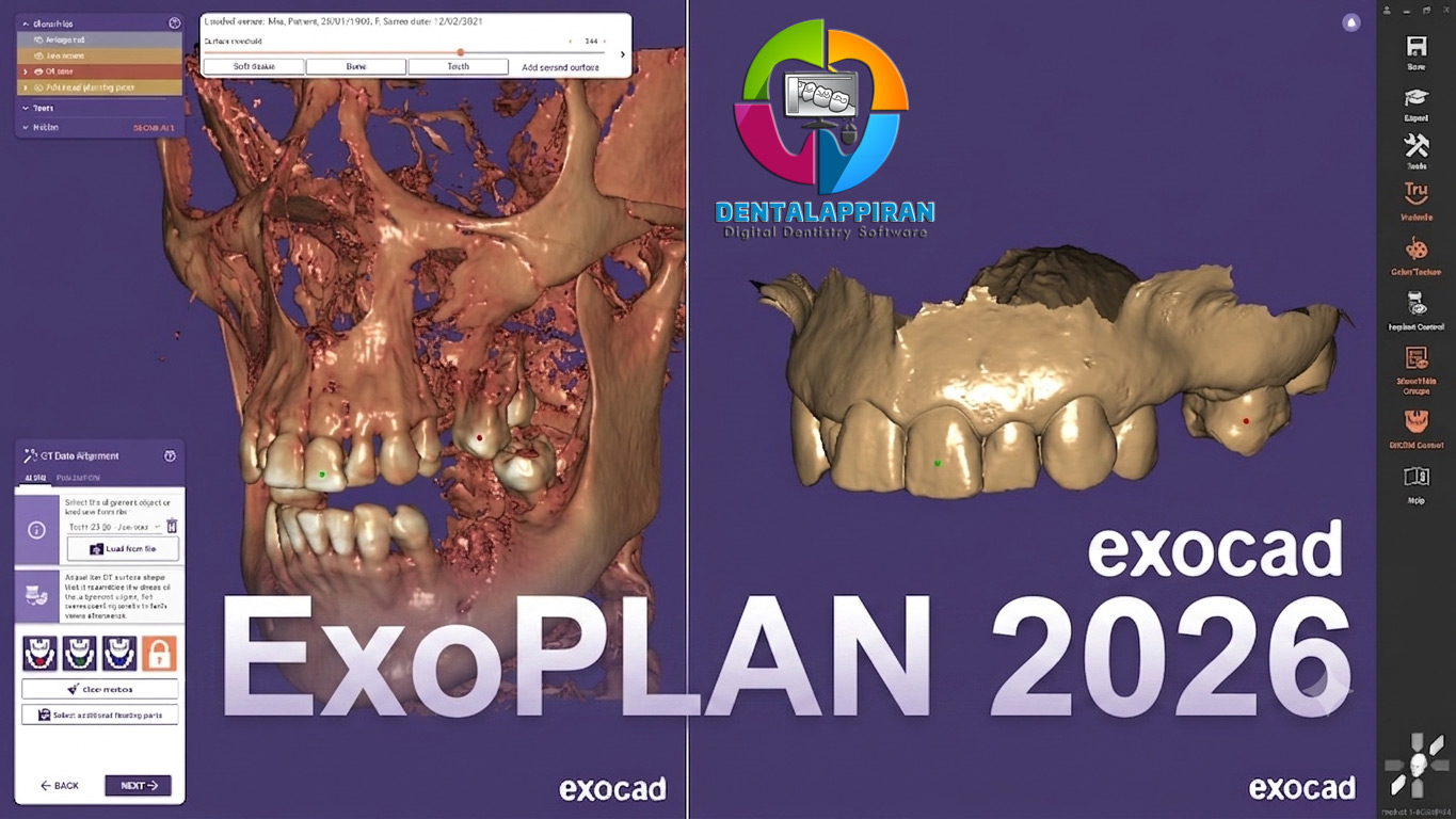 ExoPLAN-2026