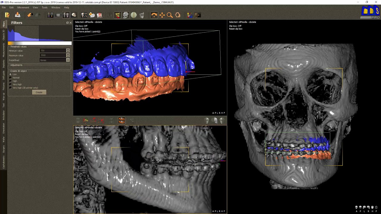 DDS Pro