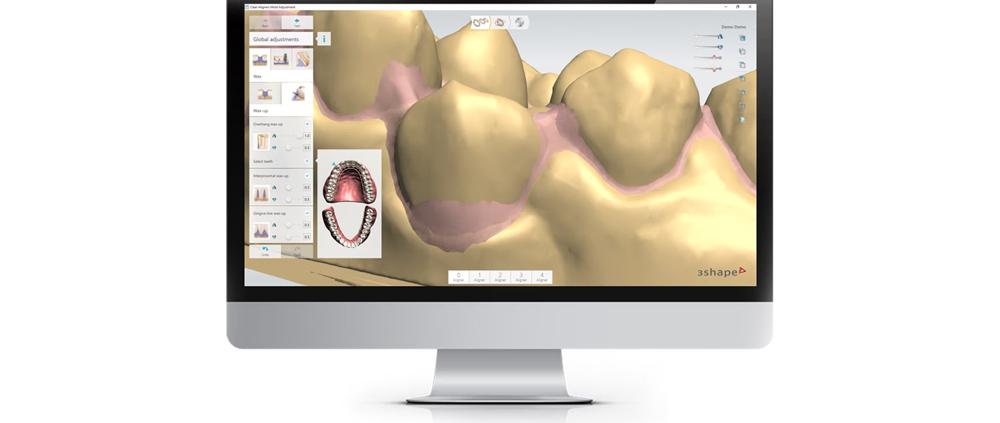 دوره کلیر الاینر تری شیب 3Shape Ortho Analyzer