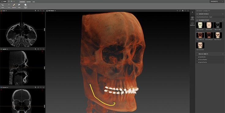 csm_Patient_model_735x370_03_bd874d3f94