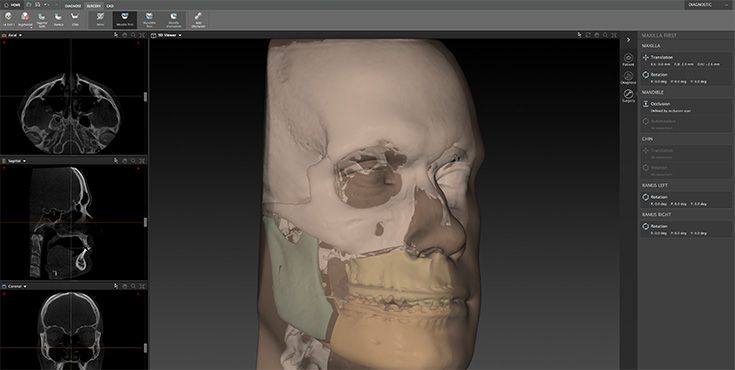 csm_Soft_tissue_simulation_735x370_03_260a6a4f00