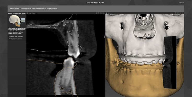 csm_Surgery_model_735x370_03_291c8250e5